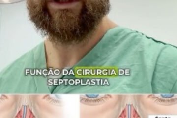 cirurgia-de-septoplastia-santo-andre-clinica-medica-sagita