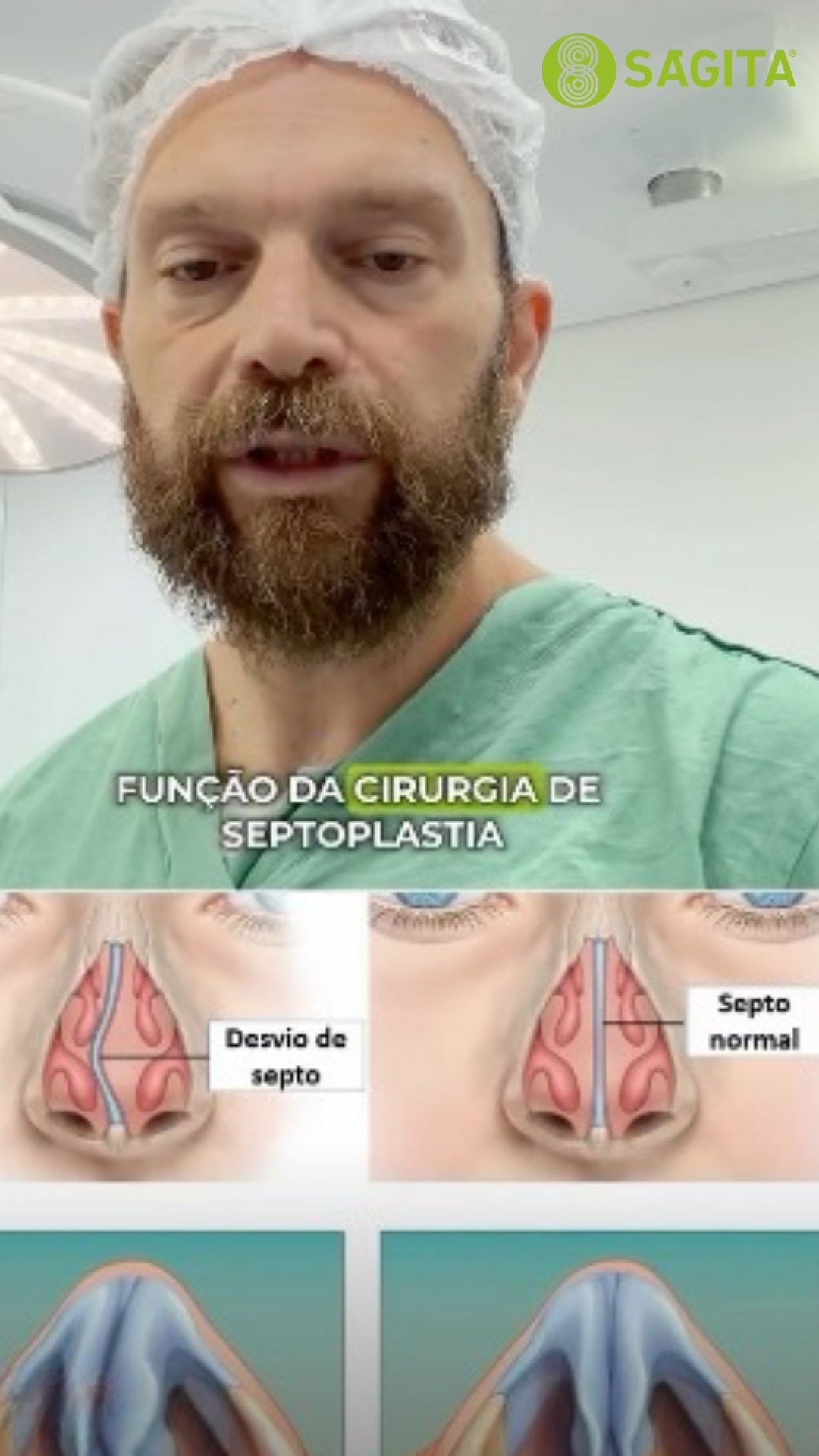 cirurgia-de-septoplastia-santo-andre-clinica-medica-sagita
