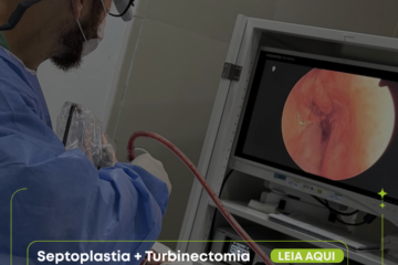 septoplastia-turbinectomia-santo-andre-abc-paulista-clinica-sagita