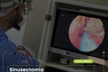 sinusectomia-santo-andre-abc-paulista-clinica-sagita