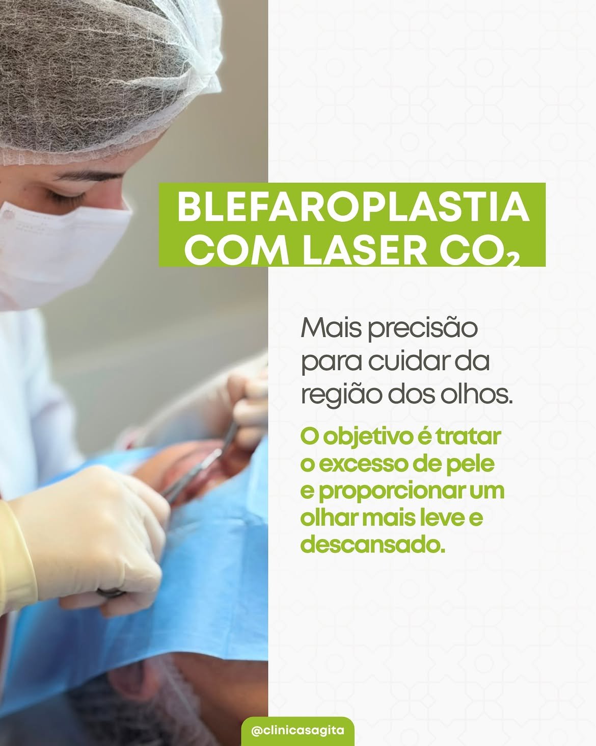 BLEFAROPLASTIA A LASER: COMO O LASER DE CO₂ PODE SER ASSOCIADO À CIRURGIA DAS PÁLPEBRAS