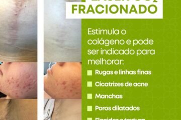 laser-co2-fracionado-clinica-medica-sagita-dermatologista-santo-andre-abc-paulista