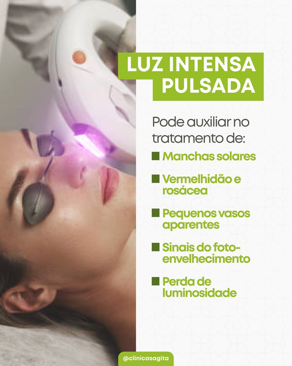 LUZ INTENSA PULSADA: PARA QUE SERVE E POR QUE ELA NÃO É SIMPLESMENTE “MAIS UM LASER”?